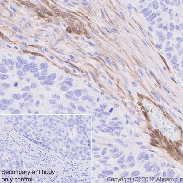 Immunohistochemistry (Formalin/PFA-fixed paraffin-embedded sections) - Anti-Calponin 1 antibody [EP798Y] - BSA and Azide free (AB216651)