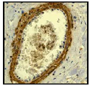 Immunohistochemistry (Formalin/PFA-fixed paraffin-embedded sections) - Anti-Calponin 1 antibody [EP798Y] - BSA and Azide free (AB216651)
