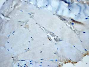 Immunohistochemistry (Formalin/PFA-fixed paraffin-embedded sections) - Anti-Calponin 1 antibody [EP798Y] - BSA and Azide free (ab216651), expandable thumbnail