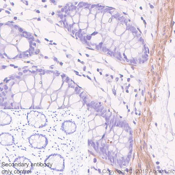 Immunohistochemistry (Formalin/PFA-fixed paraffin-embedded sections) - Anti-Calponin 1 antibody [SP180] - BSA and Azide free (AB245753)