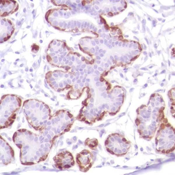 Immunohistochemistry (Formalin/PFA-fixed paraffin-embedded sections) - Anti-Calponin 1 antibody [SP180] - BSA and Azide free (AB245753)