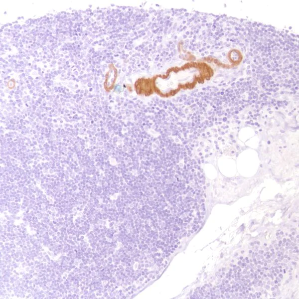 Immunohistochemistry (Formalin/PFA-fixed paraffin-embedded sections) - Anti-Calponin 1 antibody [SP180] - BSA and Azide free (AB245753)