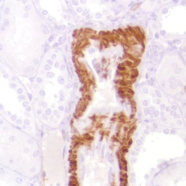 Immunohistochemistry (Formalin/PFA-fixed paraffin-embedded sections) - Anti-Calponin 1 antibody [SP180] - BSA and Azide free (AB245753)