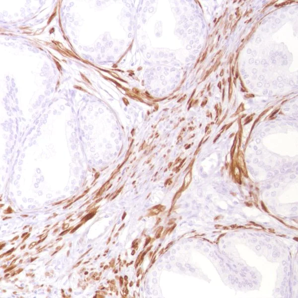 Immunohistochemistry (Formalin/PFA-fixed paraffin-embedded sections) - Anti-Calponin 1 antibody [SP180] - BSA and Azide free (AB245753)