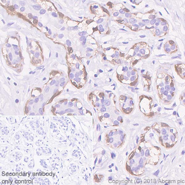 Immunohistochemistry (Formalin/PFA-fixed paraffin-embedded sections) - Anti-Calponin 1 antibody [SP180] - BSA and Azide free (AB245753)