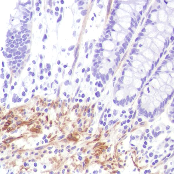 Immunohistochemistry (Formalin/PFA-fixed paraffin-embedded sections) - Anti-Calponin 1 antibody [SP180] - C-terminal (AB227660)