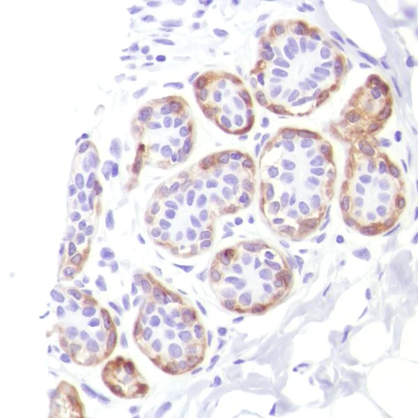 Immunohistochemistry (Formalin/PFA-fixed paraffin-embedded sections) - Anti-Calponin 1 antibody [SP181] (AB227661)