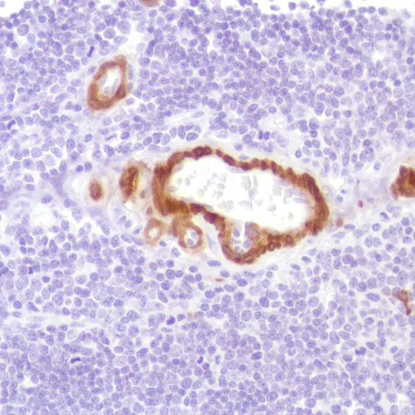 Immunohistochemistry (Formalin/PFA-fixed paraffin-embedded sections) - Anti-Calponin 1 antibody [SP181] (AB227661)