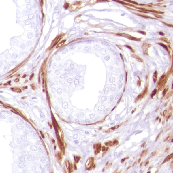 Immunohistochemistry (Formalin/PFA-fixed paraffin-embedded sections) - Anti-Calponin 1 antibody [SP181] (AB227661)