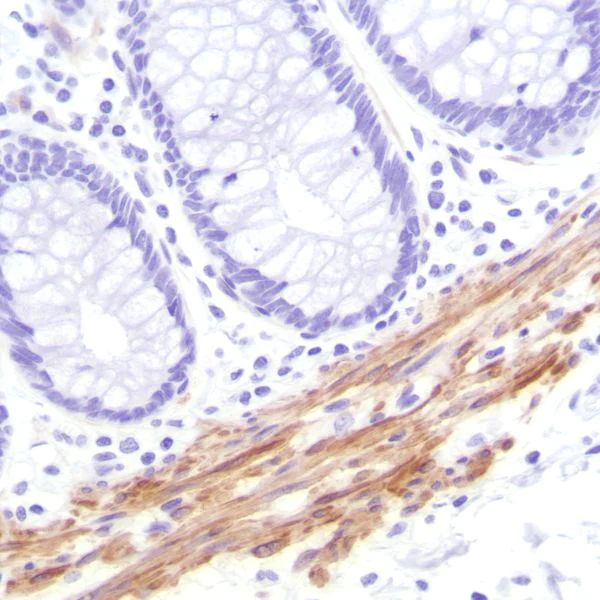 Immunohistochemistry (Formalin/PFA-fixed paraffin-embedded sections) - Anti-Calponin 1 antibody [SP181] (AB227661)