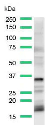 Western blot - Anti-Calponin 1 antibody [SP181] (AB227661)
