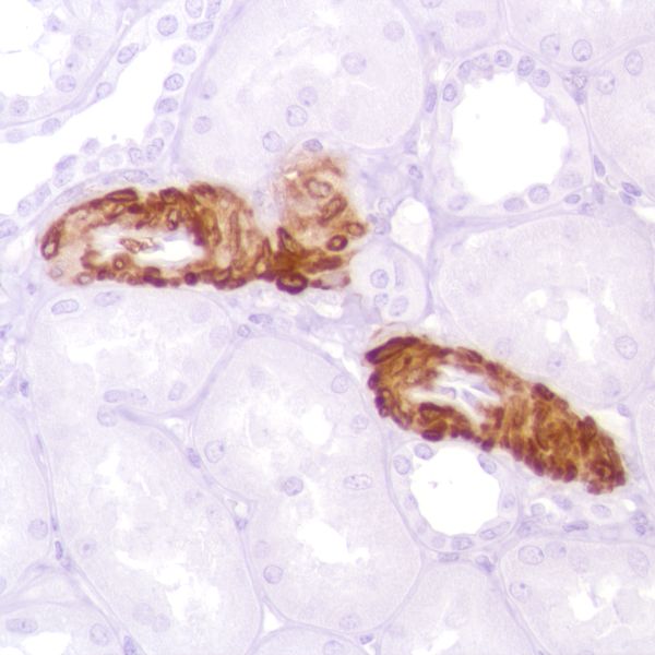 Immunohistochemistry (Formalin/PFA-fixed paraffin-embedded sections) - Anti-Calponin 1 antibody [SP181] - BSA and Azide free (AB245754)