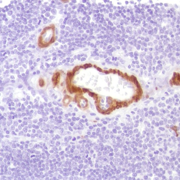Immunohistochemistry (Formalin/PFA-fixed paraffin-embedded sections) - Anti-Calponin 1 antibody [SP181] - BSA and Azide free (AB245754)