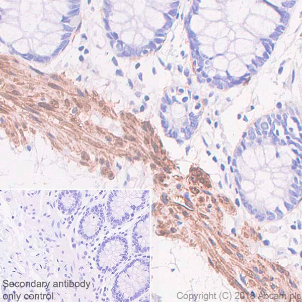 Immunohistochemistry (Formalin/PFA-fixed paraffin-embedded sections) - Anti-Calponin 1 antibody [SP193] - BSA and Azide free (AB246348)