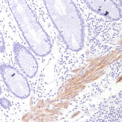 Immunohistochemistry (Formalin/PFA-fixed paraffin-embedded sections) - Anti-Calponin 1 antibody [SP193] - C-terminal (AB227667), expandable thumbnail