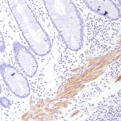 Immunohistochemistry (Formalin/PFA-fixed paraffin-embedded sections) - Anti-Calponin 1 antibody [SP193] - C-terminal (AB227667)