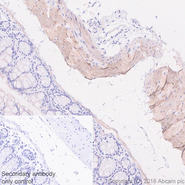 Immunohistochemistry (Formalin/PFA-fixed paraffin-embedded sections) - Anti-Calponin 1 antibody [SP193] - C-terminal (AB227667), expandable thumbnail