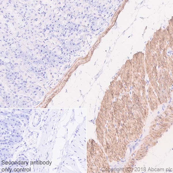 Immunohistochemistry (Formalin/PFA-fixed paraffin-embedded sections) - Anti-Calponin 1 antibody [SP193] - C-terminal (AB227667), expandable thumbnail