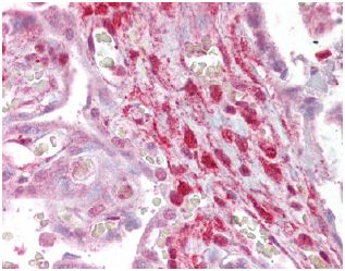Immunohistochemistry (Formalin/PFA-fixed paraffin-embedded sections) - Anti-Calponin 2 antibody (AB129331), expandable thumbnail