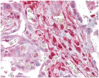 Immunohistochemistry (Formalin/PFA-fixed paraffin-embedded sections) - Anti-Calponin 2 antibody (AB129331)