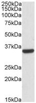 Western blot - Anti-Calponin 2 antibody (AB129331), expandable thumbnail