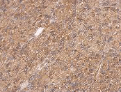 Immunohistochemistry (Formalin/PFA-fixed paraffin-embedded sections) - Anti-Calponin 3 antibody (AB151427), expandable thumbnail