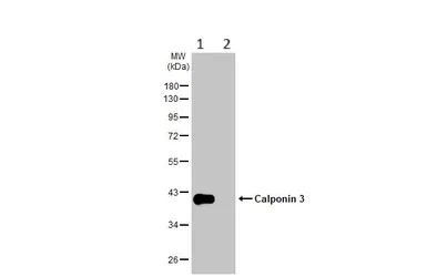 Western blot - Anti-Calponin 3 antibody (AB151427)