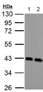 Western blot - Anti-Calponin 3 antibody (AB151427), expandable thumbnail