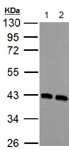Western blot - Anti-Calponin 3 antibody (AB151427)