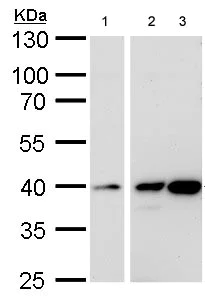Western blot - Anti-Calponin 3 antibody (AB184132)
