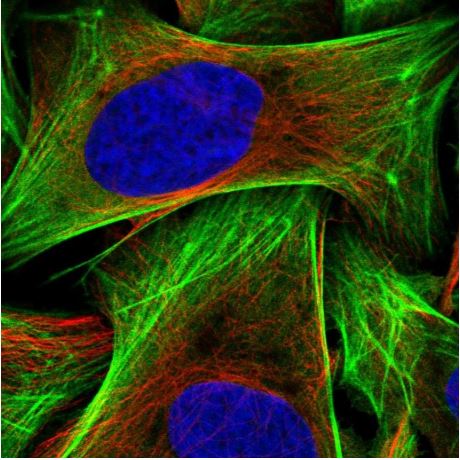Immunocytochemistry/ Immunofluorescence - Anti-Calponin 3 antibody - C-terminal (AB204365), expandable thumbnail