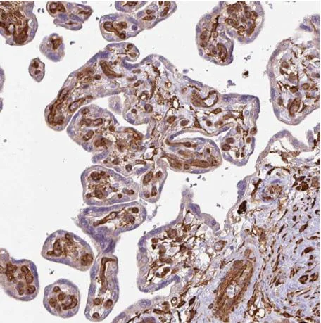 Immunohistochemistry (Formalin/PFA-fixed paraffin-embedded sections) - Anti-Calponin 3 antibody - C-terminal (AB204365)