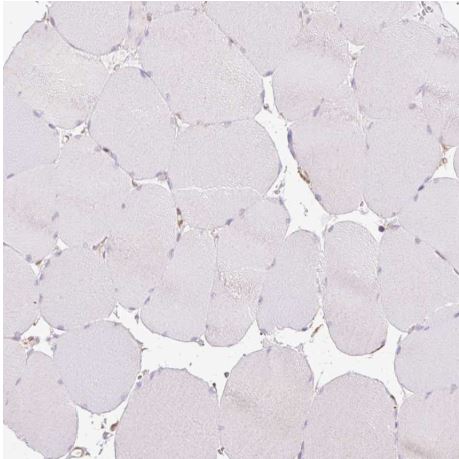 Immunohistochemistry (Formalin/PFA-fixed paraffin-embedded sections) - Anti-Calponin 3 antibody - C-terminal (ab204365), expandable thumbnail