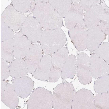 Immunohistochemistry (Formalin/PFA-fixed paraffin-embedded sections) - Anti-Calponin 3 antibody - C-terminal (AB204365)