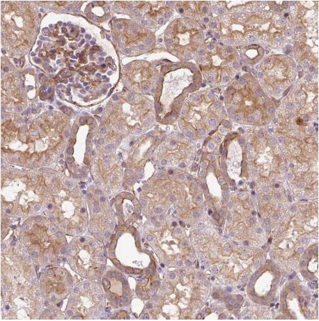 Immunohistochemistry (Formalin/PFA-fixed paraffin-embedded sections) - Anti-Calponin 3 antibody - C-terminal (AB204365), expandable thumbnail