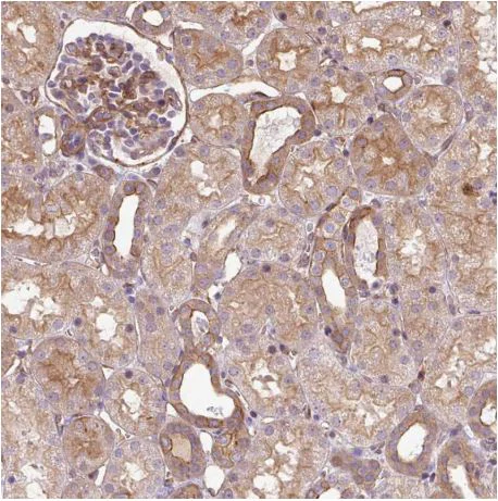 Immunohistochemistry (Formalin/PFA-fixed paraffin-embedded sections) - Anti-Calponin 3 antibody - C-terminal (AB204365)