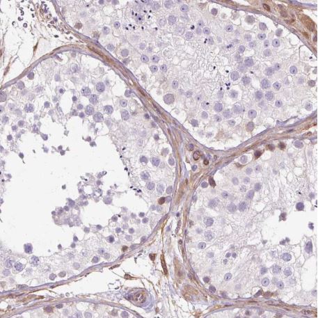 Immunohistochemistry (Formalin/PFA-fixed paraffin-embedded sections) - Anti-Calponin 3 antibody - C-terminal (AB204365), expandable thumbnail