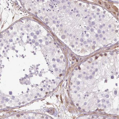 Immunohistochemistry (Formalin/PFA-fixed paraffin-embedded sections) - Anti-Calponin 3 antibody - C-terminal (AB204365)