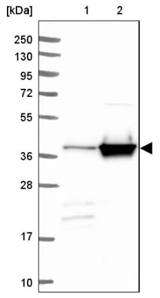 Western blot - Anti-Calponin 3 antibody - C-terminal (AB204365)