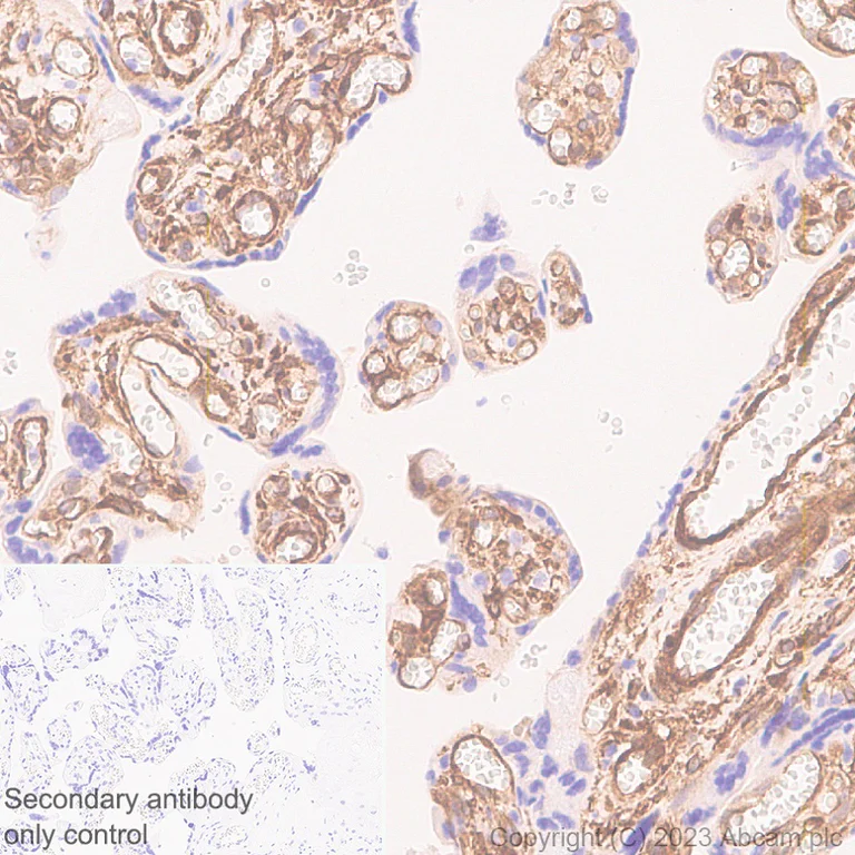 Immunohistochemistry (Formalin/PFA-fixed paraffin-embedded sections) - Anti-Calponin 3 antibody [EPR28430-76] (AB314329)