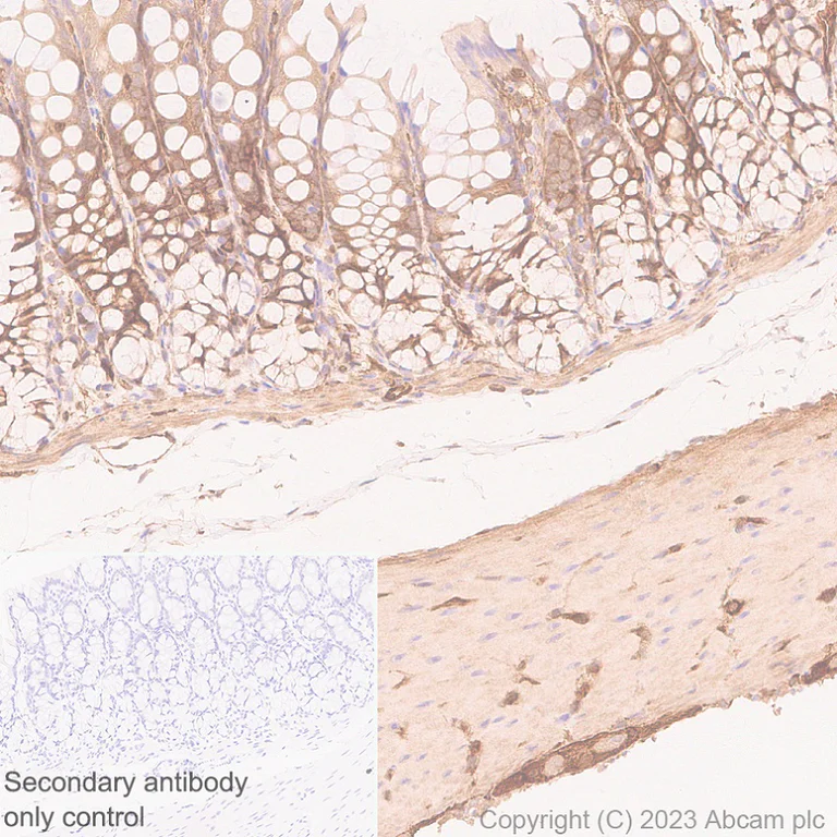 Immunohistochemistry (Formalin/PFA-fixed paraffin-embedded sections) - Anti-Calponin 3 antibody [EPR28430-76] (AB314329)
