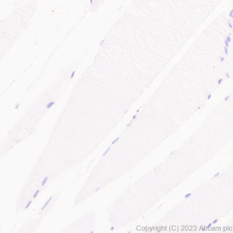 Immunohistochemistry (Formalin/PFA-fixed paraffin-embedded sections) - Anti-Calponin 3 antibody [EPR28430-76] (AB314329)