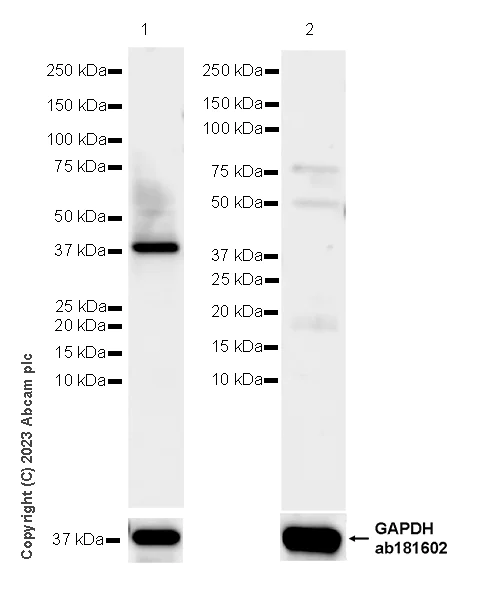 Western blot - Anti-Calponin 3 antibody [EPR28430-76] (AB314329)