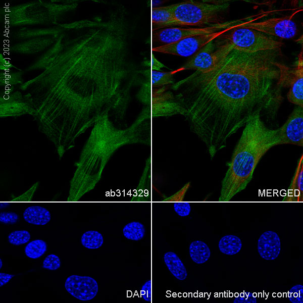 Immunocytochemistry/ Immunofluorescence - Anti-Calponin 3 antibody [EPR28430-76] - BSA and Azide free (AB314330), expandable thumbnail