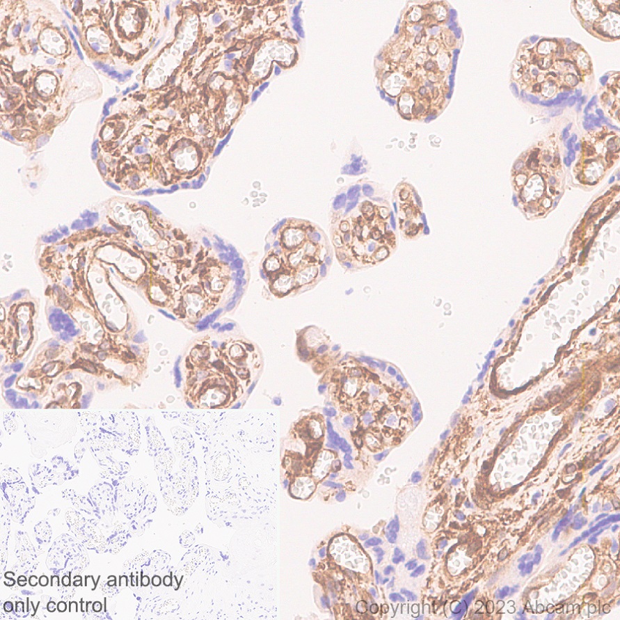 Immunohistochemistry (Formalin/PFA-fixed paraffin-embedded sections) - Anti-Calponin 3 antibody [EPR28430-76] - BSA and Azide free (ab314330), expandable thumbnail
