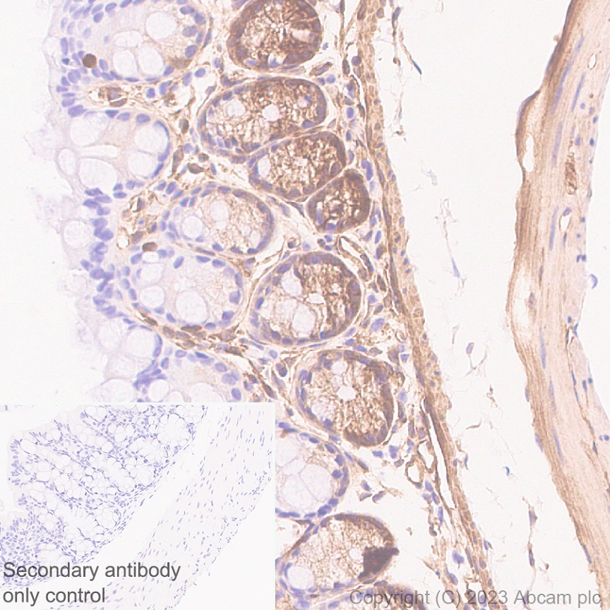 Immunohistochemistry (Formalin/PFA-fixed paraffin-embedded sections) - Anti-Calponin 3 antibody [EPR28430-76] - BSA and Azide free (AB314330), expandable thumbnail