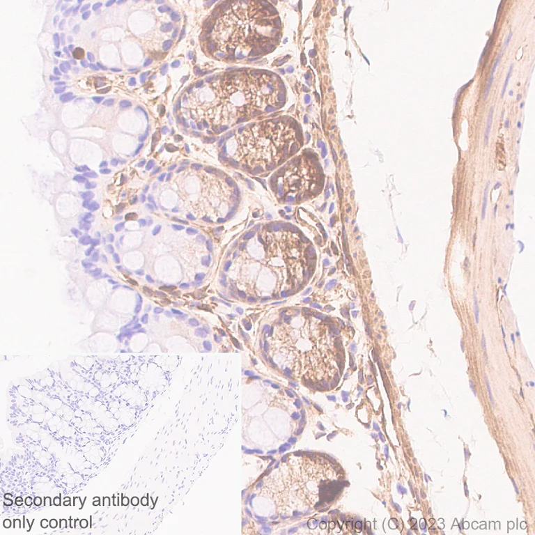 Immunohistochemistry (Formalin/PFA-fixed paraffin-embedded sections) - Anti-Calponin 3 antibody [EPR28430-76] - BSA and Azide free (AB314330)
