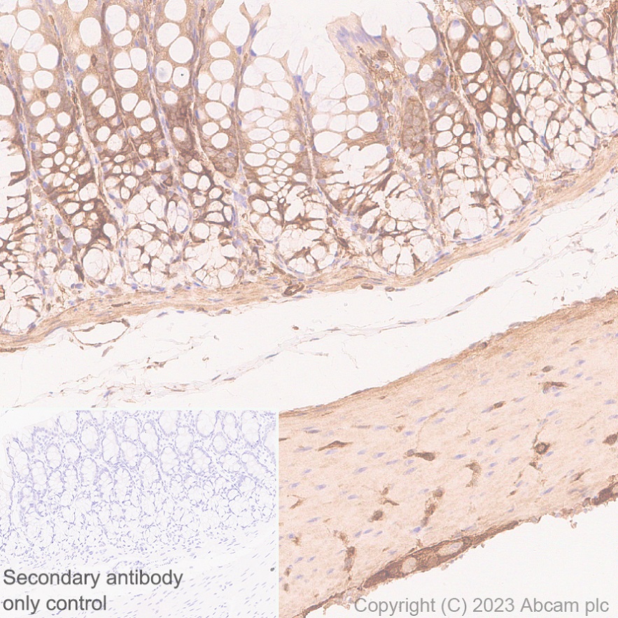 Immunohistochemistry (Formalin/PFA-fixed paraffin-embedded sections) - Anti-Calponin 3 antibody [EPR28430-76] - BSA and Azide free (AB314330), expandable thumbnail
