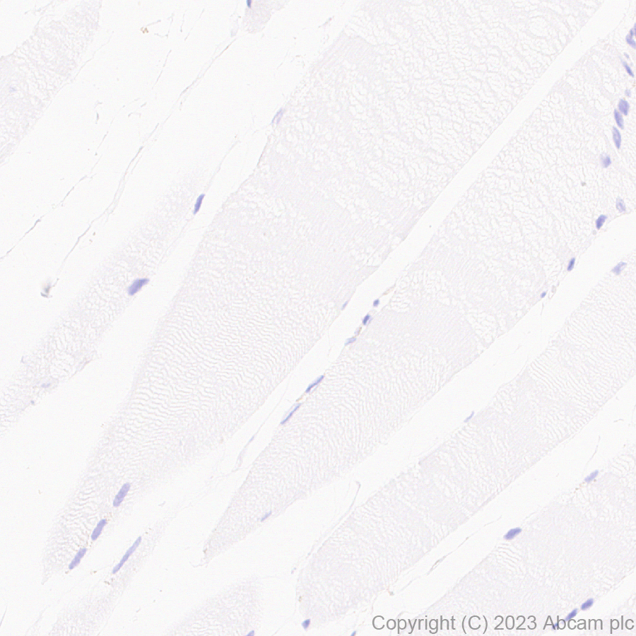 Immunohistochemistry (Formalin/PFA-fixed paraffin-embedded sections) - Anti-Calponin 3 antibody [EPR28430-76] - BSA and Azide free (AB314330), expandable thumbnail