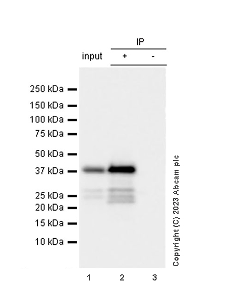 Immunoprecipitation - Anti-Calponin 3 antibody [EPR28430-76] - BSA and Azide free (ab314330), expandable thumbnail